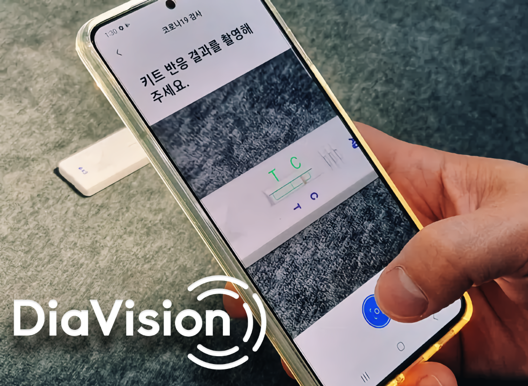 디아비전(DiaVision) 대표이미지