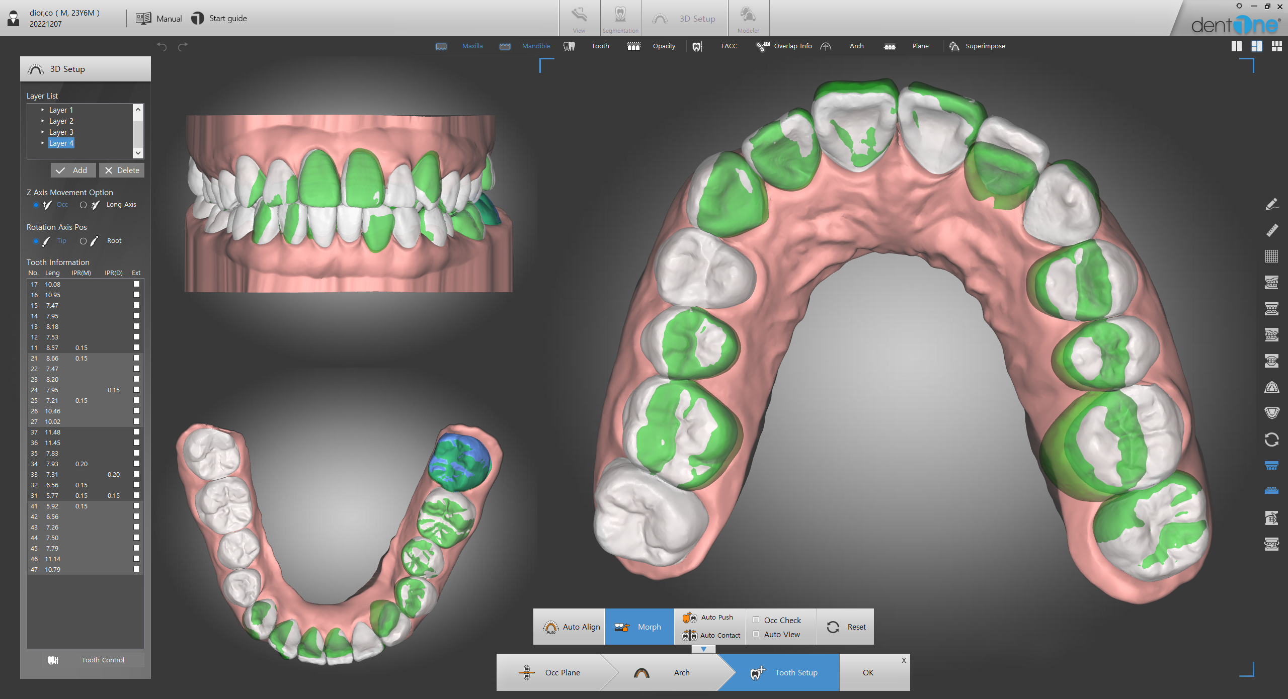 디오코 대표이미지